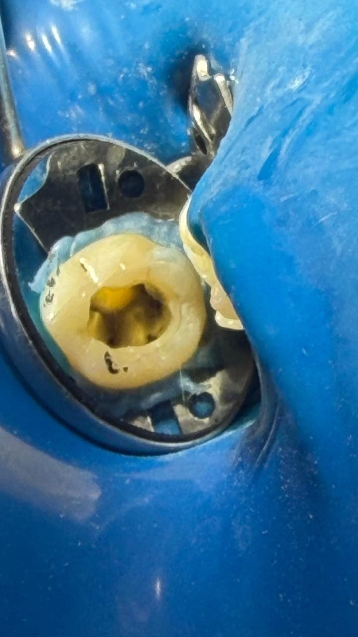 Dente sob isolamento absoluto com grampo e lençol de borracha, acesso realizado